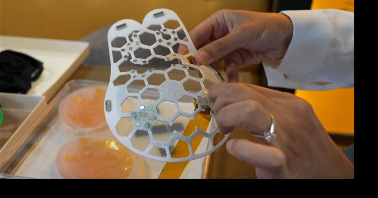 Health Beat: Ultrasound bra detects breast cancer at home | Health Beat ...