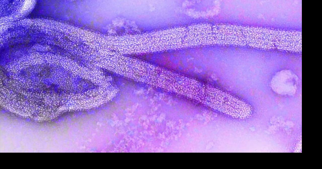 Local expert monitors rare Ebola strain spreading rapidly in Africa