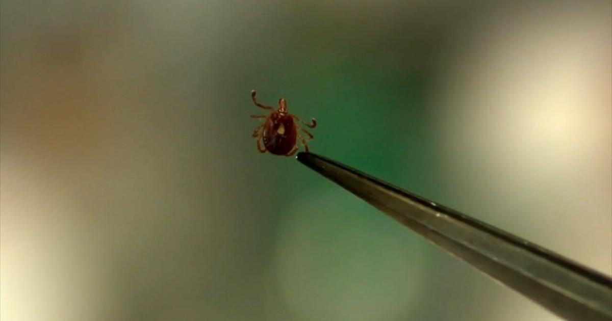 Health Beat: CDC reports sharp rise in tick‑related hospital visits ...