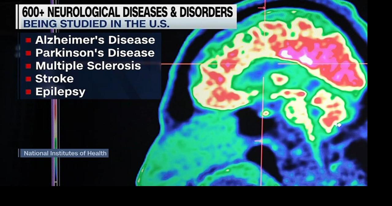 Health Beat: Cleveland Clinic studies neurodegenerative diseases in attempt to find a cure