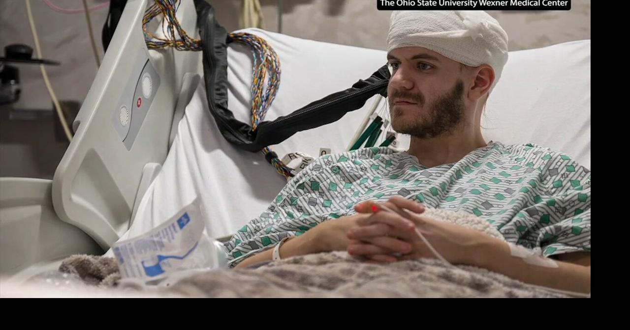 Health Beat: Treating epilepsy