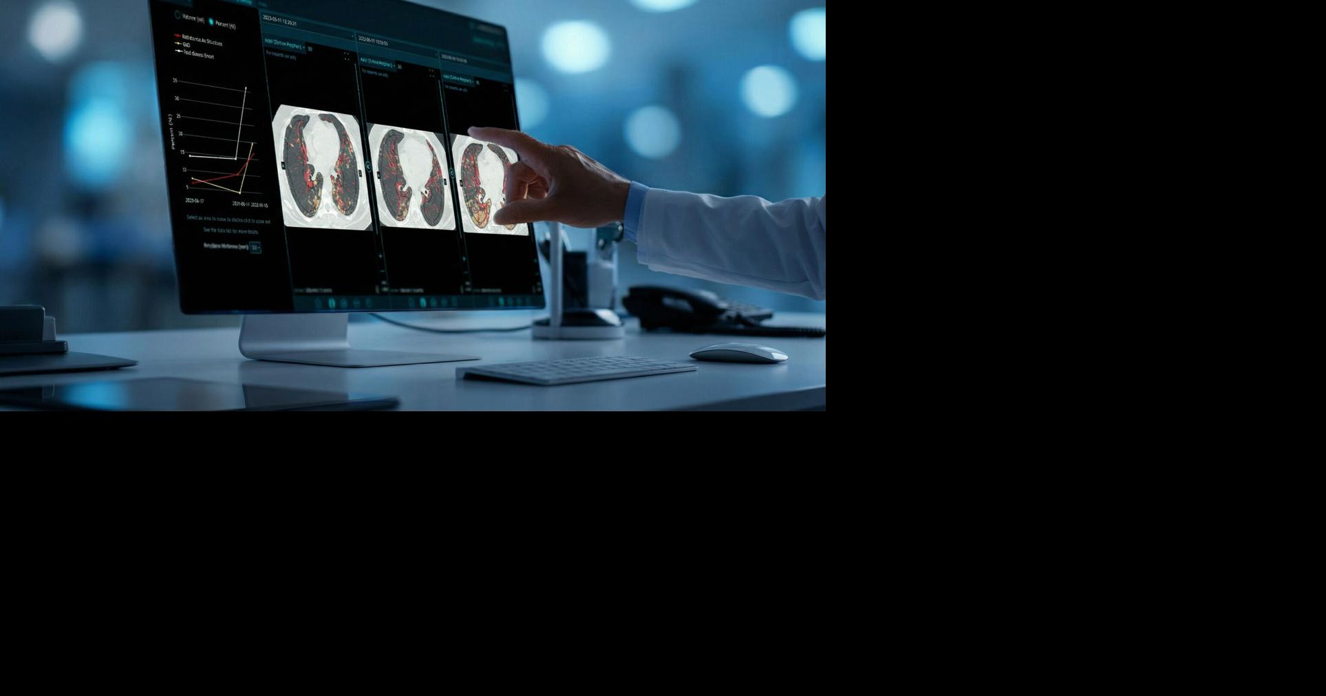 Brainomix e-Lung AI Imaging Technology Selected as Co-Primary Endpoint in Boehringer Ingelheim Phase 3 Clinical Trial in Pulmonary Fibrosis