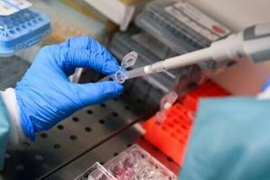 New drugs raise hopes of pancreatic cancer breakthrough