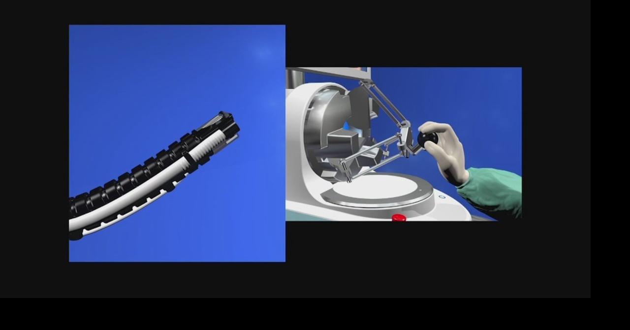 Robotic snake helps find, remove tumors | Health | wfmz.com