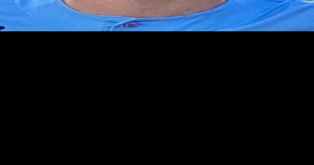 Area briefs Millbrook's Burgreen signs with Shepherd baseball