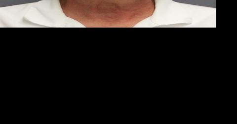Doctor accused of assaulting patients allegedly kissed and touched them - Vimarsana News