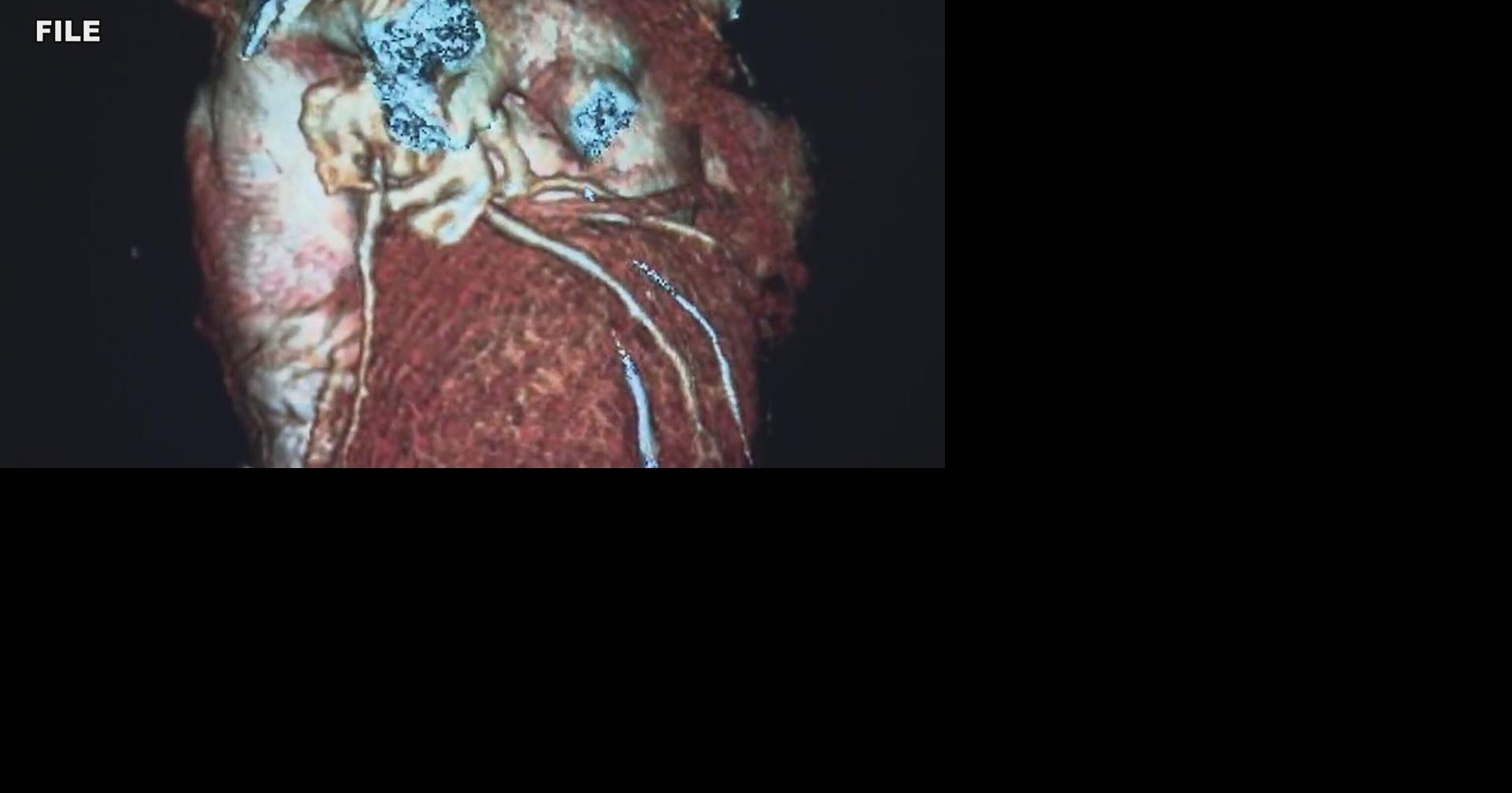 Medical Matters: 'It's never too late' to be heart-healthy