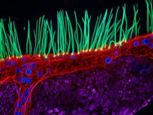Nikon Microscopy Photo Contest Winner Faces Scrutiny Over AI Use