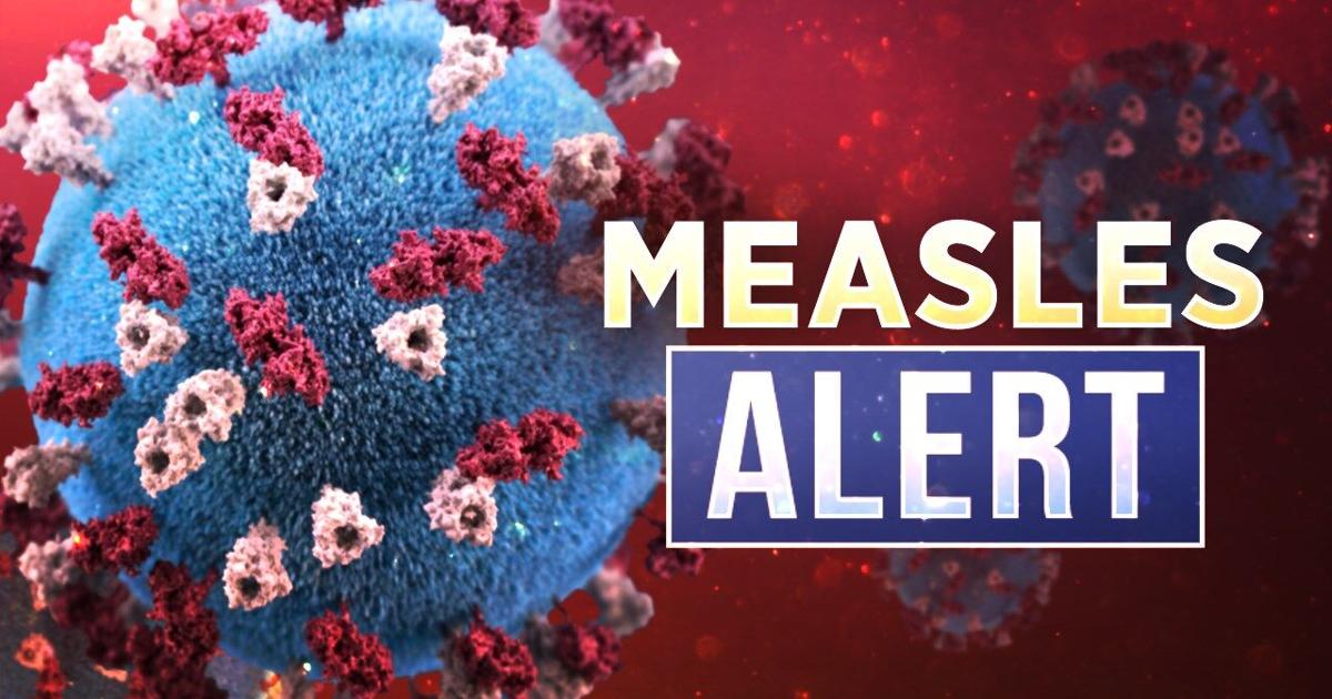 WI DHS identifies public locations where people may have been exposed to measles WKOW WI DHS identifies public locations where people may have been exposed to measles WKOW