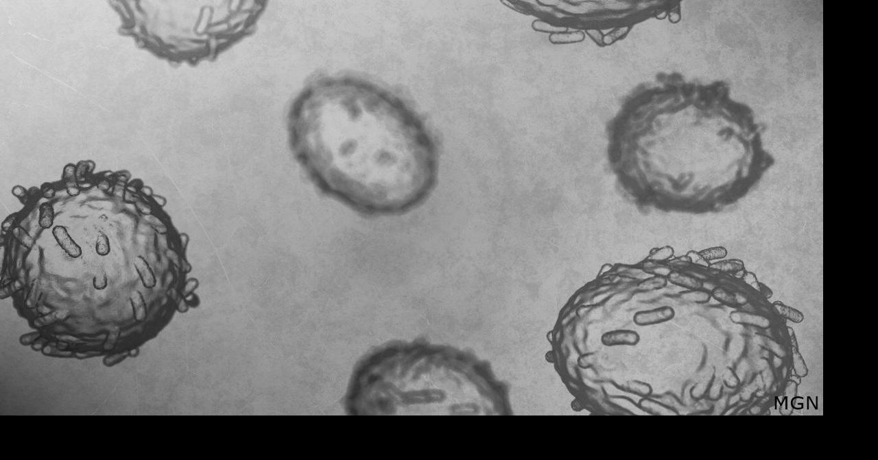 Wisconsin DHS confirms 5 mpox cases - WKOW