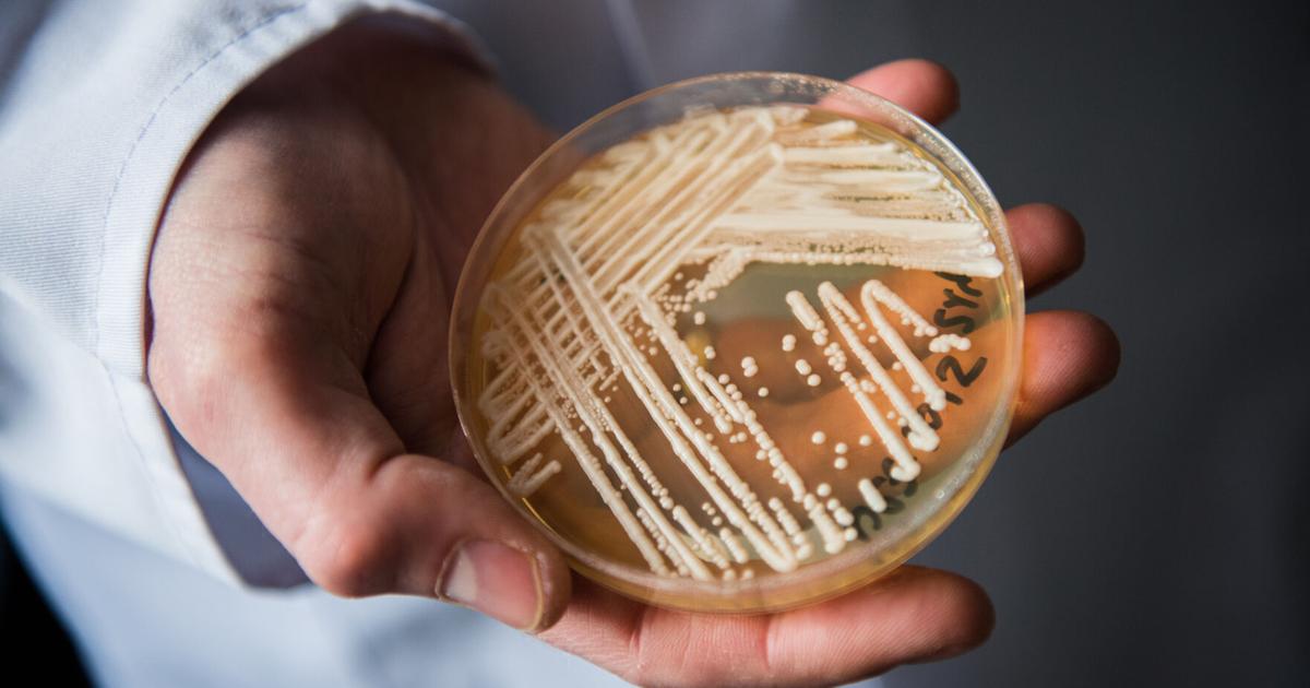 UW Health confirms it has seen cases of emerging deadly fungus, says public shouldn UW Health confirms it has seen cases of emerging deadly fungus, says public shouldn