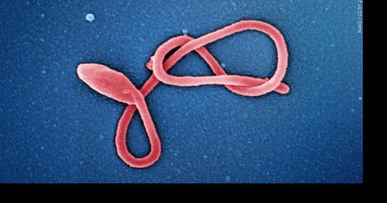 Milwaukee Health Department monitoring 3 for Ebola