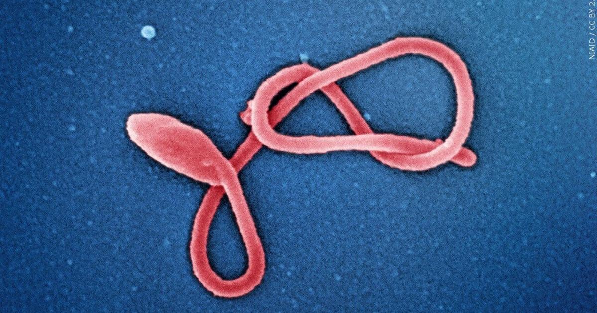 Milwaukee Health Department monitoring 3 for Ebola