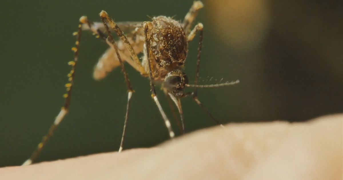 Wisconsin health officials respond to confirmed West Nile deaths | Health Wisconsin health officials respond to confirmed West Nile deaths | Health