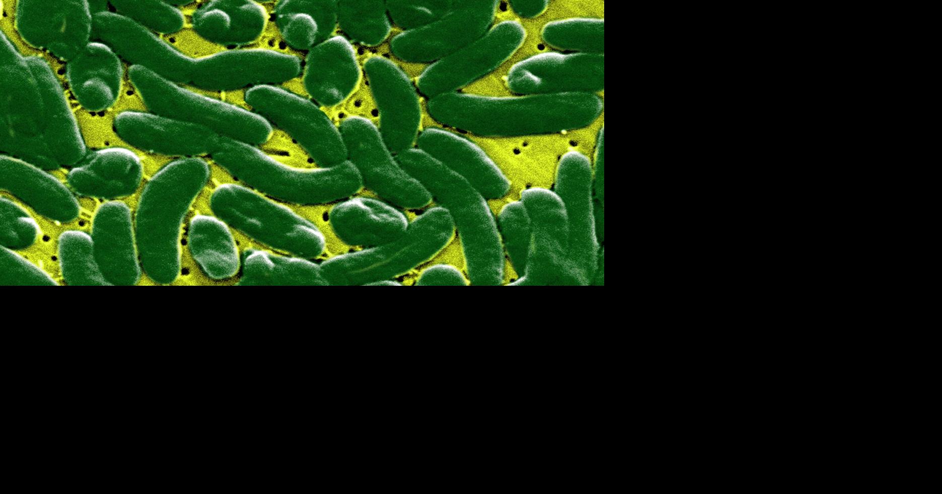 Flesheating bacteria cases rise in Florida after hurricanes Helene and