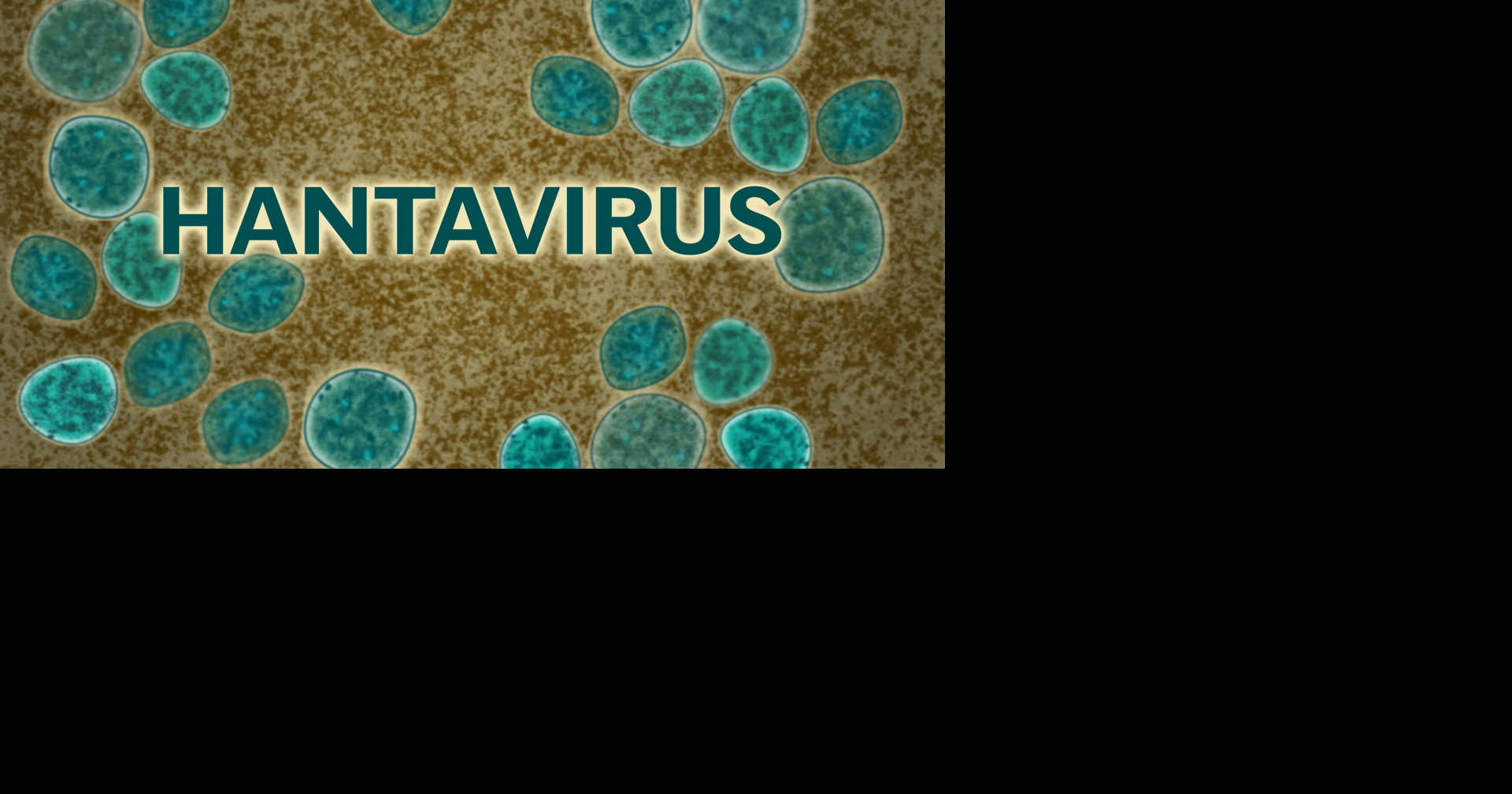New York City, Orange and Westchester County Residents Face 42-Day Monitoring for Hantavirus