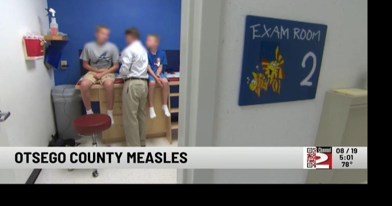 Otsego County Records First Reported Measles Case in at Least 34 Years