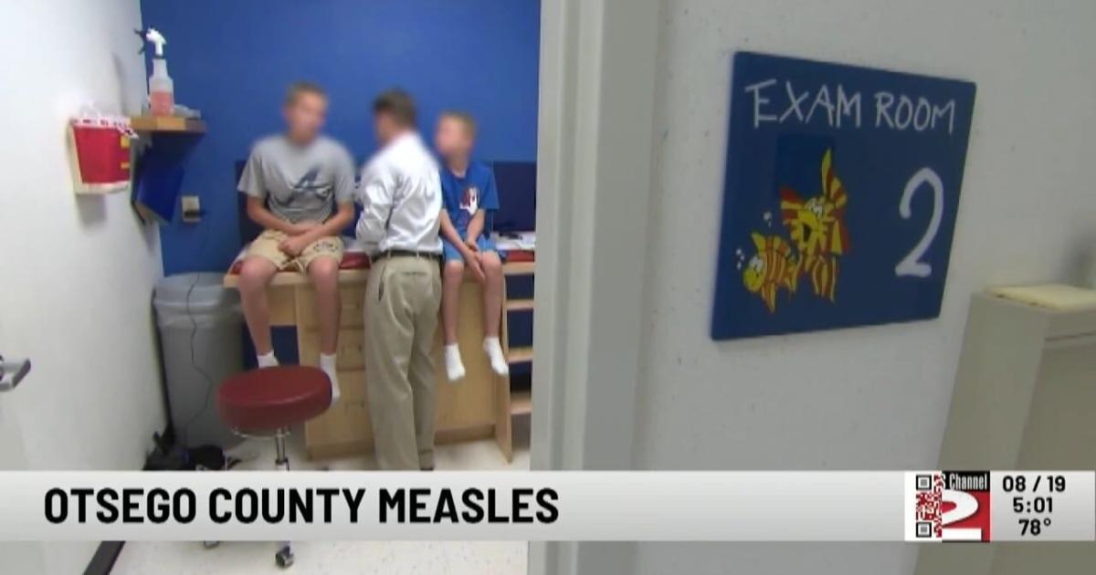 Otsego County Records First Reported Measles Case in at Least 34 Years