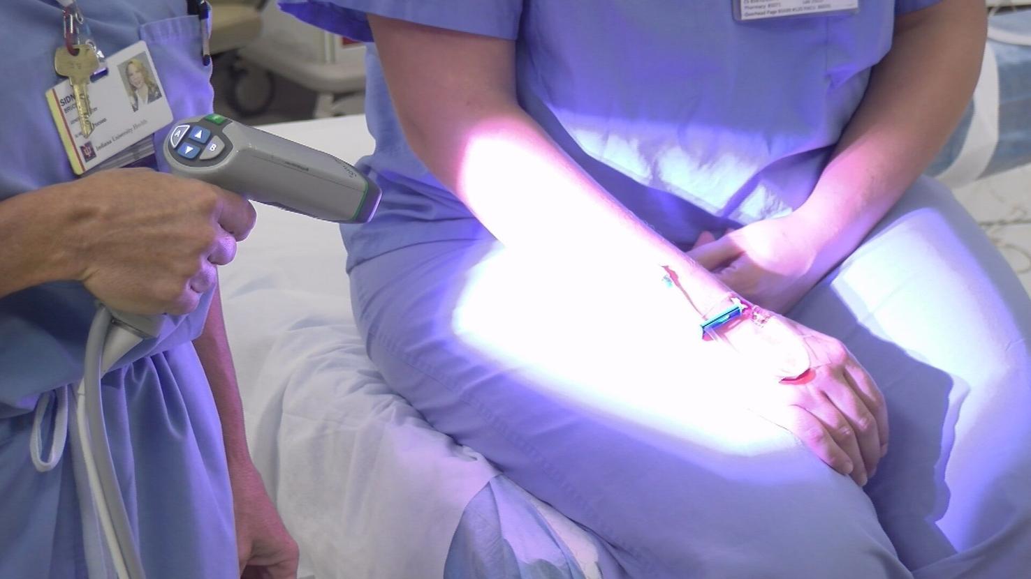 advances-in-technology-helping-iu-health-arnett-doctors-treat-breast