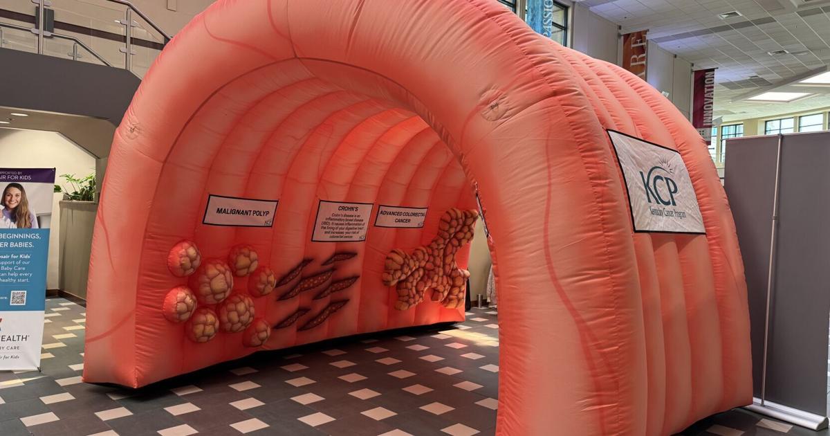 Inflatable display, local surgeon educate visitors on colon cancer ...