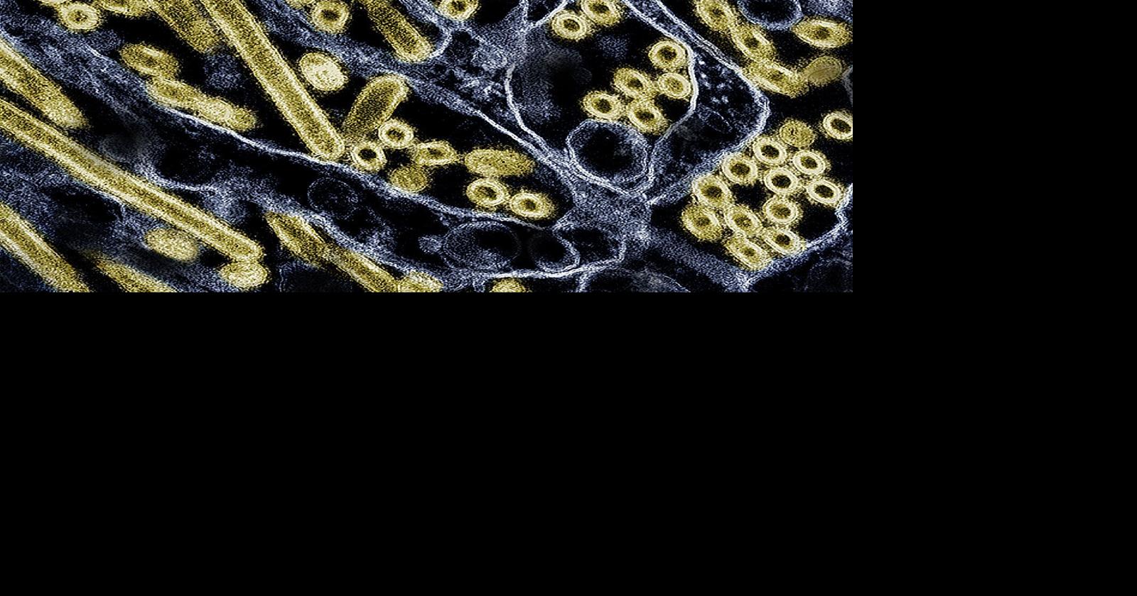 Blood tests confirm a second person in Missouri caught bird flu without