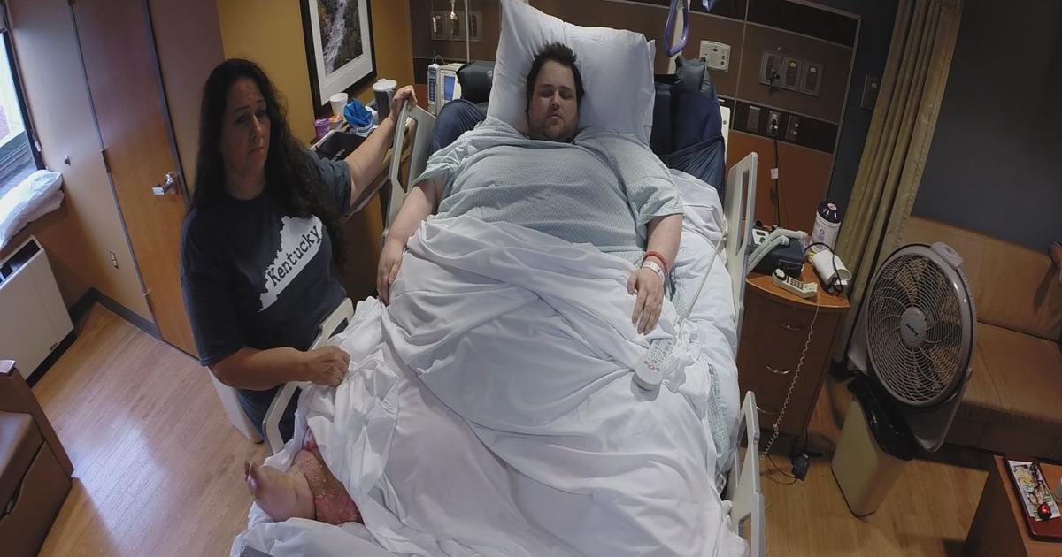 700 Man 700 pound man still looking for hospital that can take care of his ...