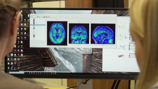 New Brain Secrets Uncovered