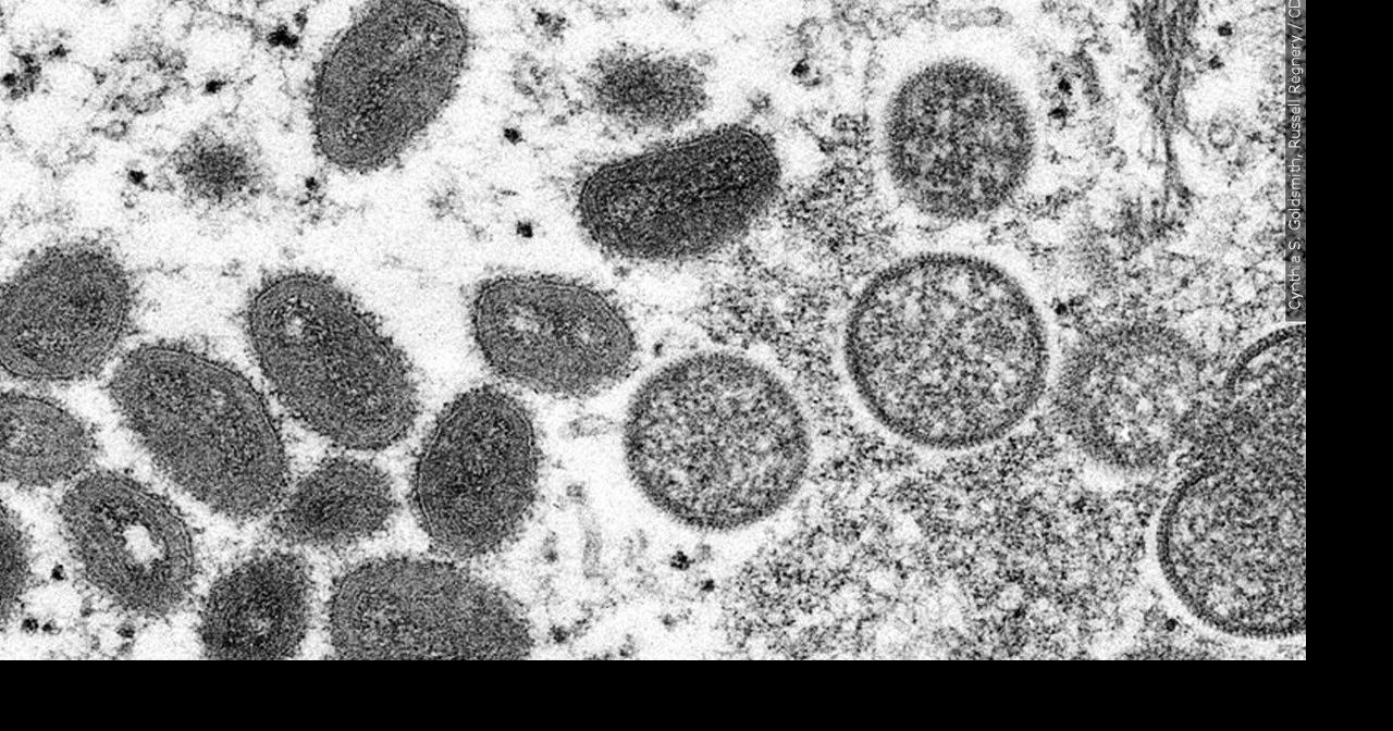 CDC’s travel advisory on monkeypox: ‘Practice enhanced precautions’ | News