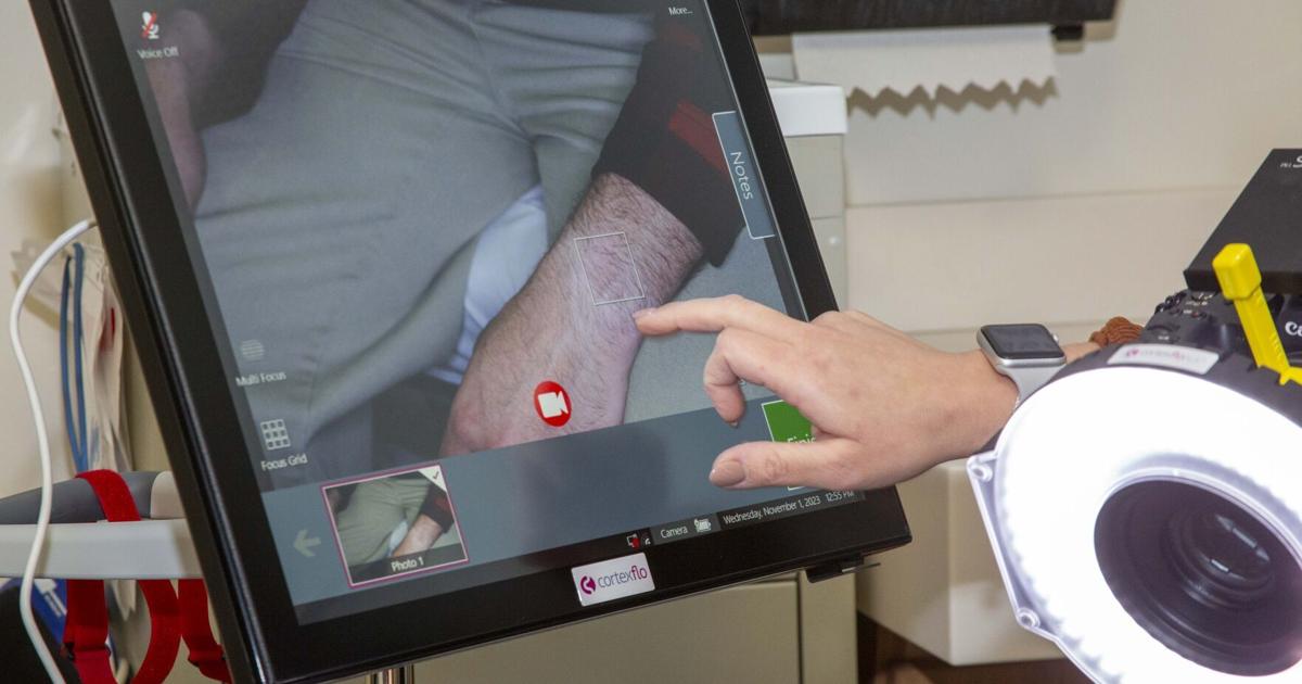 Local hospital gets new forensic camera in hopes of attaining justice ...