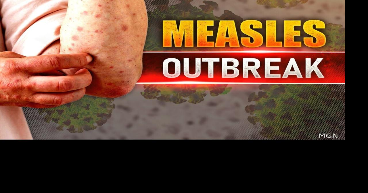 Measles outbreak spreads to Richland County as officials warn of exposure risk amid growing outbreak