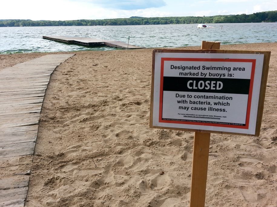 3 Chippewa Co. beaches test elevated high for cryptosporidium