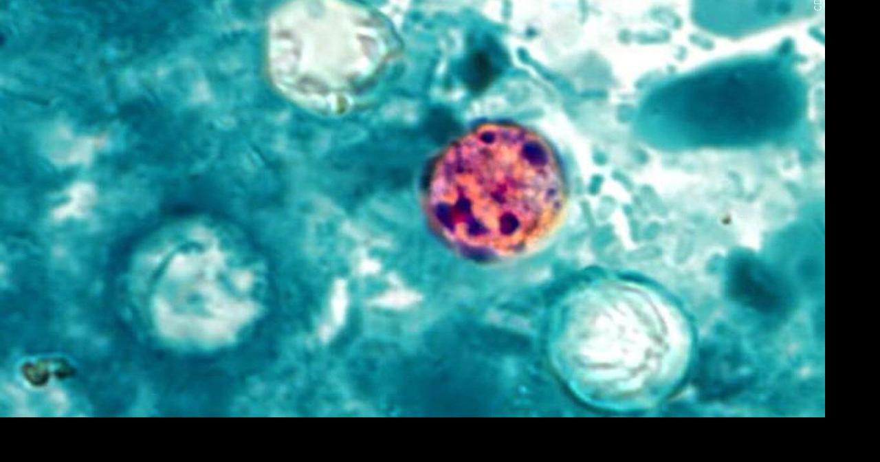 Over 215 cases of cyclosporiasis reported in Illinois