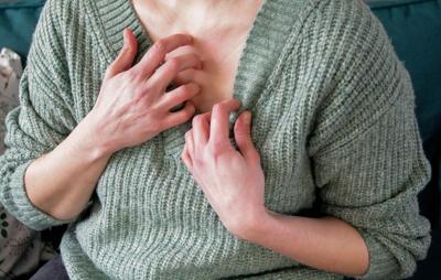 What you should know about stress rashes