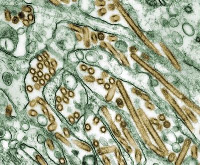 To prevent supercharged flu virus, CDC pushes seasonal flu vaccines to farmworkers at risk of coinfection with bird flu