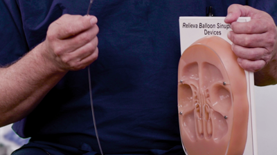 medical minute deviated septum
