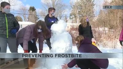 frostbite