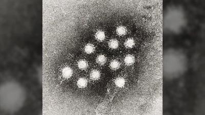 Hep A