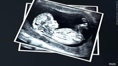 abortion