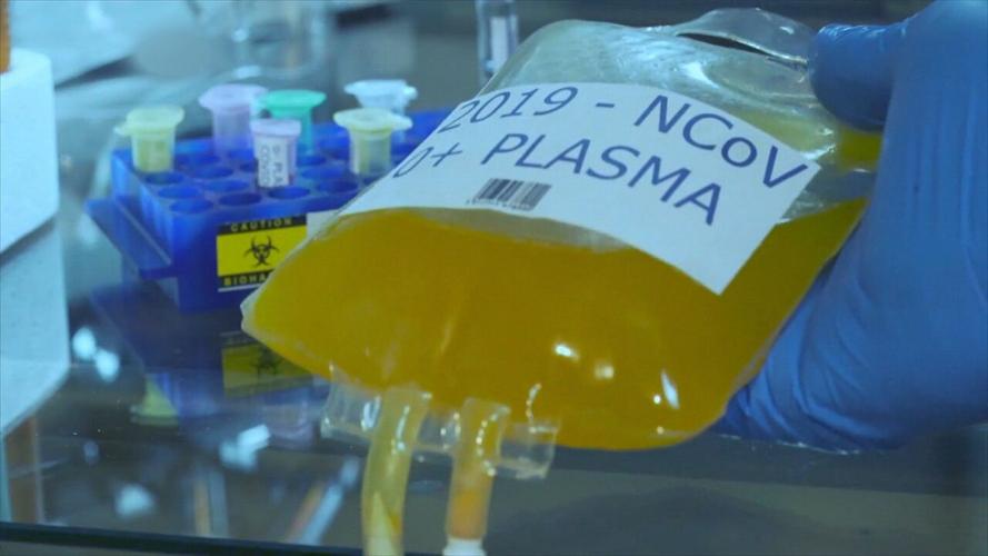 plasma