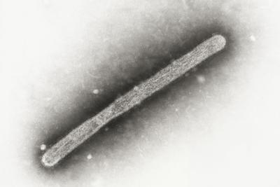 America’s first bird flu death reported in Louisiana