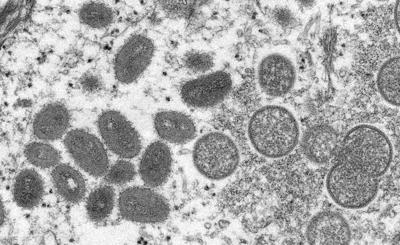 WHO renames monkeypox as 'mpox'