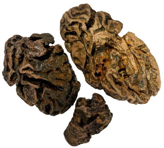 ‘Extraordinary’ archive of ancient brains could help shed light on mental illness
