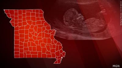 Missouri Abortion