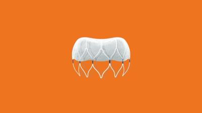 KY HEART IMPLANT