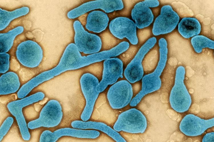 CDC warns doctors to watch for Marburg virus amid outbreaks in two African nations