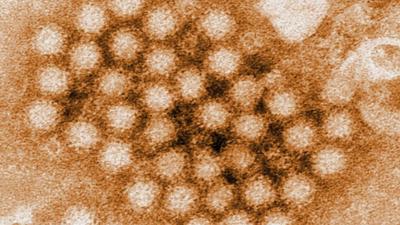 Norovirus