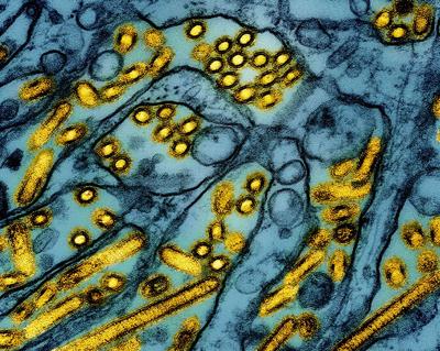 In US first, child tests positive for bird flu