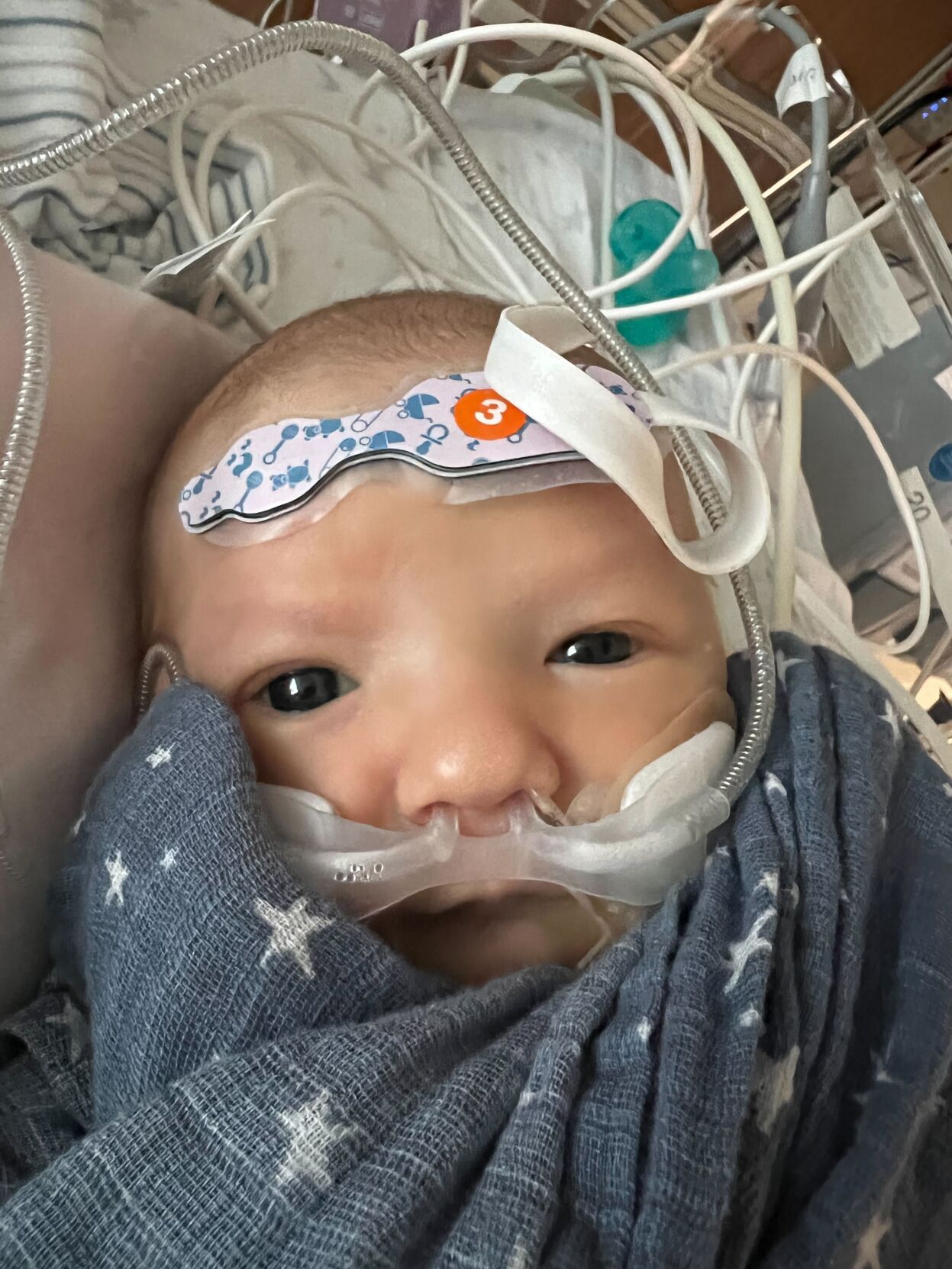 Groundbreaking procedure allows heart repairs to grow with children, new study shows