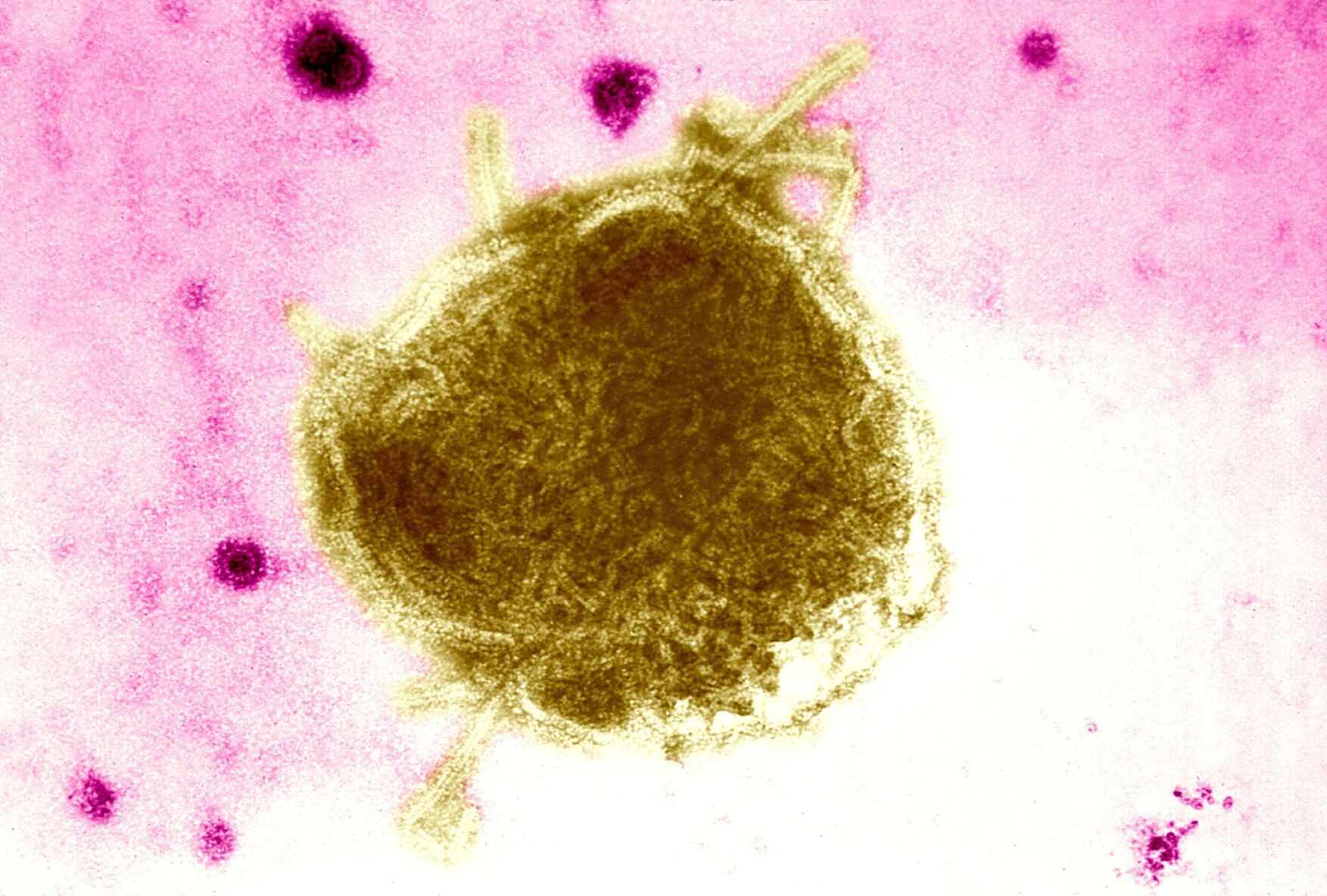 Child in West Texas is first US measles death in a decade
