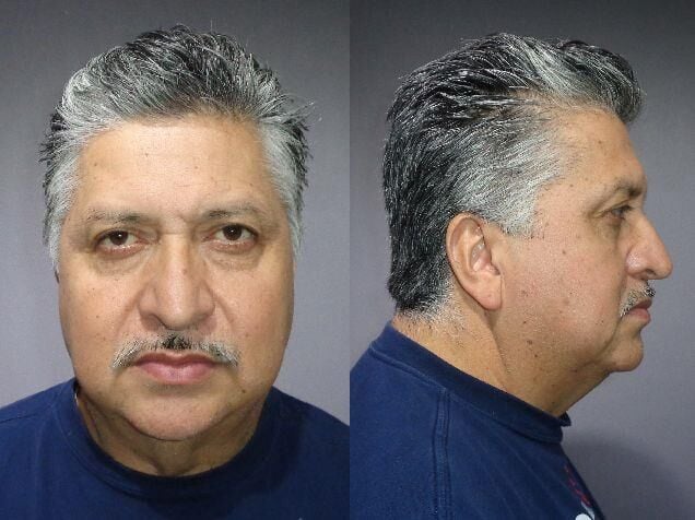 Yorkville Man Arrested on Sexual Assault Charges | Local News ...